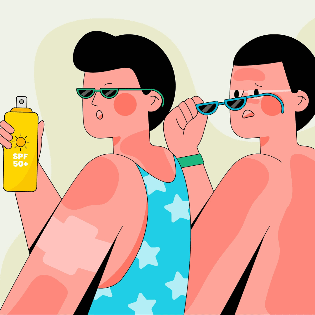 illustratie van drie mensen die met zonnebril half op achterom kijken. Hun lichaam is op verschillende plekken verbrandt. Een heeft een fles zonnebrand vast.